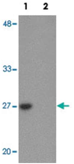 TMEM59, Rabbit, Polyclonal Antibody, Abnova 100 &mu;g | Buy Online | Abnova Corporation | Fisher Scientific