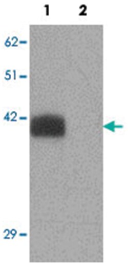 SLC39A2 Rabbit anti-Human, Mouse, Rat, Polyclonal Antibody, Abnova 100&mu;g;