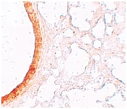 SLC39A3, Rabbit, Polyclonal Antibody, Abnova 100 &mu;g | Buy Online | Abnova | Fisher Scientific