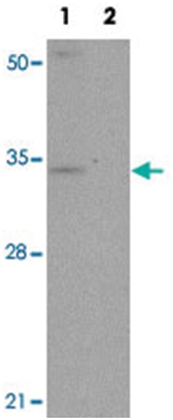 SLC39A3, Rabbit, Polyclonal Antibody, Abnova 100 &mu;g | Buy Online | Abnova | Fisher Scientific