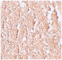 SLC39A10 Rabbit anti-Human, Mouse, Rat, Polyclonal Antibody, Abnova 100&mu;g;