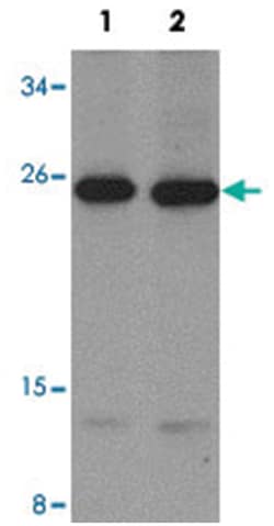 LIF, Rabbit, Polyclonal Antibody, Abnova 100 &mu;g | Buy Online | Abnova Corporation | Fisher Scientific