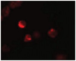 LIF, Rabbit, Polyclonal Antibody, Abnova 100 &mu;g | Buy Online | Abnova Corporation | Fisher Scientific