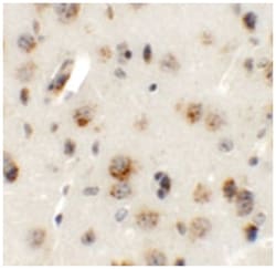 AP3B2 Rabbit anti-Human, Mouse, Rat, Polyclonal Antibody, Abnova 100&mu;g;