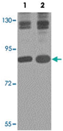 ZNF281, Rabbit, Polyclonal Antibody, Abnova 100&mu;g; Unlabeled:Antibodies,