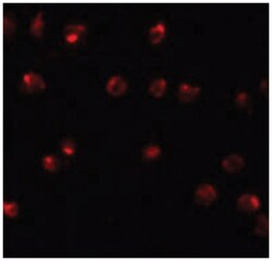ZNF281, Rabbit, Polyclonal Antibody, Abnova 100&mu;g; Unlabeled:Antibodies,