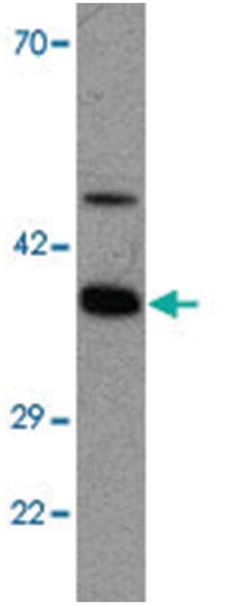 APOA4 Rabbit anti-Chicken, Human, Polyclonal Antibody, Abnova 100&mu;g;