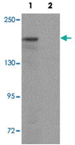 ATP2C1, Rabbit, Polyclonal Antibody, Abnova 100&mu;g; Unlabeled:Antibodies,