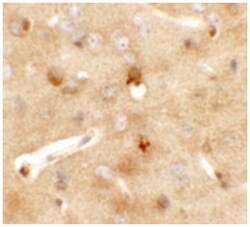 CCDC141 Rabbit anti-Human, Mouse, Polyclonal Antibody, Abnova 100 &mu;g | Buy Online | Abnova Corporation | Fisher Scientific
