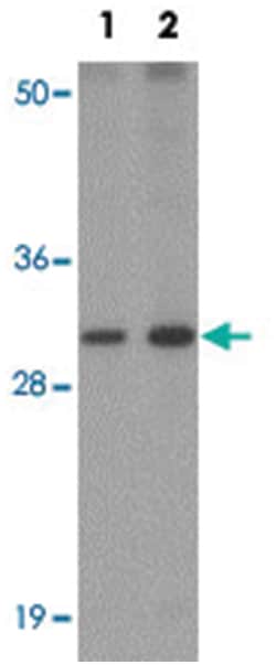 AP3S1, Rabbit, Polyclonal Antibody, Abnova 100&mu;g; Unlabeled:Antibodies,