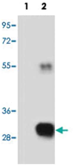 RCE1, Rabbit, Polyclonal Antibody, Abnova 400&mu;L; Unlabeled:Antibodies,