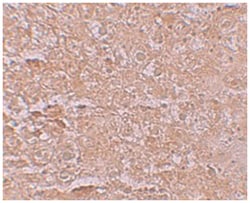 SLC39A14 Rabbit anti-Human, Mouse, Rat, Polyclonal Antibody, Abnova 100&mu;g;