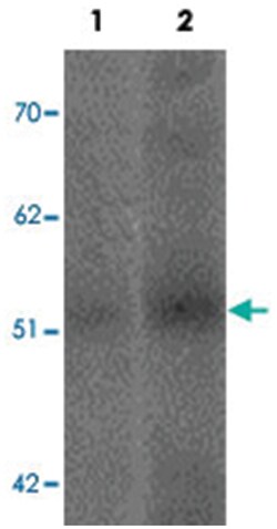 SLC39A14 Rabbit anti-Human, Mouse, Rat, Polyclonal Antibody, Abnova 100&mu;g;