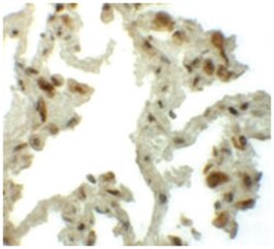 TM4SF1 Rabbit anti-Human, Mouse, Rat, Polyclonal Antibody, Abnova 100&mu;g;