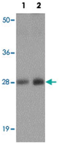 TM4SF1 Rabbit anti-Human, Mouse, Rat, Polyclonal Antibody, Abnova 100&mu;g;