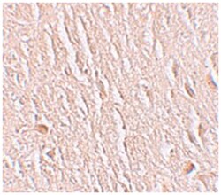 LRRTM3, Rabbit, Polyclonal Antibody, Abnova 100&mu;g; Unlabeled:Antibodies,