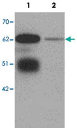 LRRTM3, Rabbit, Polyclonal Antibody, Abnova 100&mu;g; Unlabeled:Antibodies,