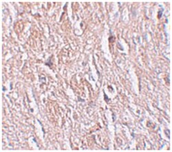 LRRTM4, Rabbit, Polyclonal Antibody, Abnova 100&mu;g; Unlabeled:Antibodies,