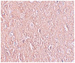 LRRTM2, Rabbit, Polyclonal Antibody, Abnova 100&mu;g; Unlabeled:Antibodies,