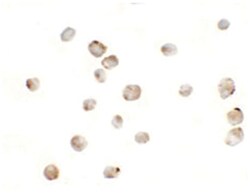 MSI2, Rabbit, Polyclonal Antibody, Abnova 100&mu;g; Unlabeled:Antibodies,
