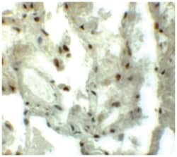 GCOM1, Rabbit, Polyclonal Antibody, Abnova 100 &mu;g | Buy Online | Abnova | Fisher Scientific