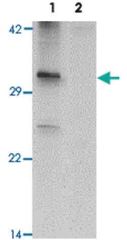 NKX3-2, Rabbit, Polyclonal Antibody, Abnova 100 &mu;g | Buy Online | Abnova | Fisher Scientific