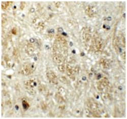 PRR5, Rabbit, Polyclonal Antibody, Abnova 100&mu;g; Unlabeled:Antibodies,