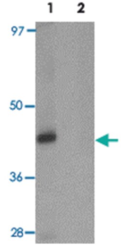 PRR5, Rabbit, Polyclonal Antibody, Abnova 100&mu;g; Unlabeled:Antibodies,