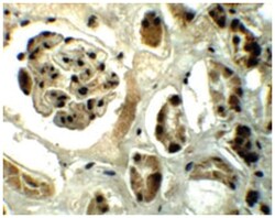 DPF2, Rabbit, Polyclonal Antibody, Abnova 100&mu;g; Unlabeled:Antibodies,