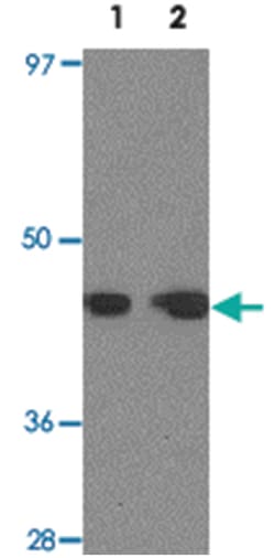 DPF2, Rabbit, Polyclonal Antibody, Abnova 100&mu;g; Unlabeled:Antibodies,