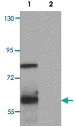 TRMT12, Rabbit, Polyclonal Antibody, Abnova 100&mu;g; Unlabeled:Antibodies,
