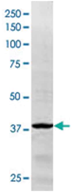 IDH1 Goat anti-Yeast, Polyclonal Antibody, Abnova 100 &mu;g | Buy Online | Abnova Corporation | Fisher Scientific