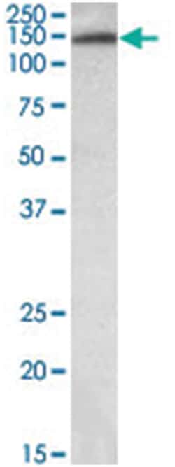 ITIH4 Goat anti-Human, Polyclonal Antibody, Abnova 100&mu;g; Unlabeled:Antibodies,