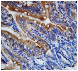 Cx3cl1, Rabbit, Polyclonal Antibody, Abnova 100&mu;g; Unlabeled:Antibodies,