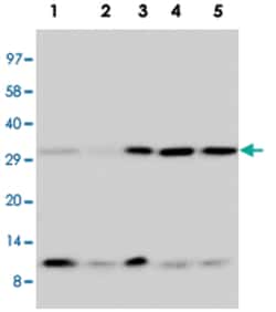 Ubiquitin Rabbit anti-Human, Mouse, Rat, Polyclonal Antibody, Abnova 100&mu;g;