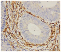 LGALS1 Rabbit anti-Human, Polyclonal Antibody, Abnova 100 &mu;g | Buy Online | Abnova Corporation | Fisher Scientific