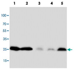 PTN Rabbit anti-Human, Rat, Polyclonal Antibody, Abnova 100&mu;g; Unlabeled:Antibodies,