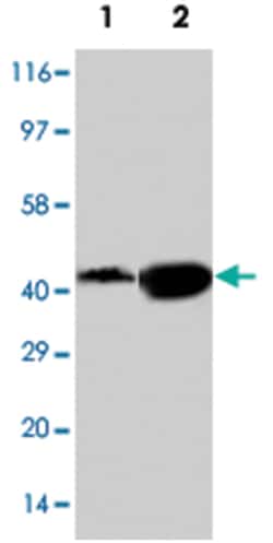 NDRG1, Rabbit, Polyclonal Antibody, Abnova 100&mu;g; Unlabeled:Antibodies,