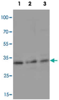 CASP6 Rabbit anti-Human, Polyclonal Antibody, Abnova 100&mu;g; Unlabeled:Antibodies,