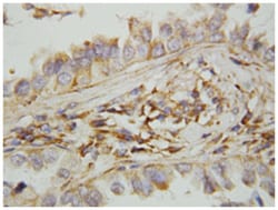 CXCL9, Rabbit, Polyclonal Antibody, Abnova 100&mu;g; Unlabeled:Antibodies,