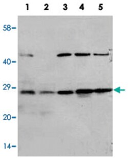CA1, Rabbit, Polyclonal Antibody, Abnova 100&mu;g; Unlabeled:Antibodies,