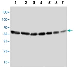 ANXA6 Rabbit anti-Human, Mouse, Rat, Polyclonal Antibody, Abnova 100&mu;g;