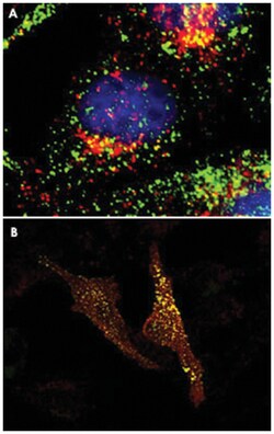 CDC42BPA, Rabbit, Polyclonal Antibody, Abnova 100&mu;g; Unlabeled:Antibodies,