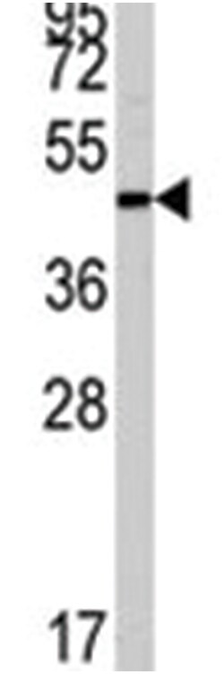 ZIC3, Rabbit, Polyclonal Antibody, Abnova 400&mu;L; Unlabeled:Antibodies,