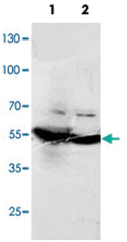 DLD Rabbit anti-Human, Mouse, Rat, Polyclonal Antibody, Abnova 100&mu;g;