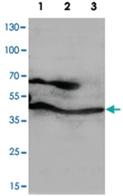 PPID, Rabbit, Polyclonal Antibody, Abnova 100&mu;g; Unlabeled:Antibodies,