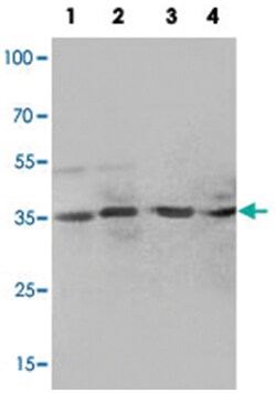 MTA1, Rabbit, Polyclonal Antibody, Abnova 100&mu;g; Unlabeled:Antibodies,