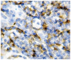 IL7, Rabbit, Polyclonal Antibody, Abnova 100&mu;g; Unlabeled:Antibodies,