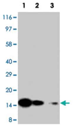 IL7, Rabbit, Polyclonal Antibody, Abnova 100&mu;g; Unlabeled:Antibodies,
