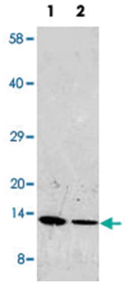 RETN Rabbit anti-Mouse, Polyclonal Antibody, Abnova 100&mu;g; Unlabeled:Antibodies,
